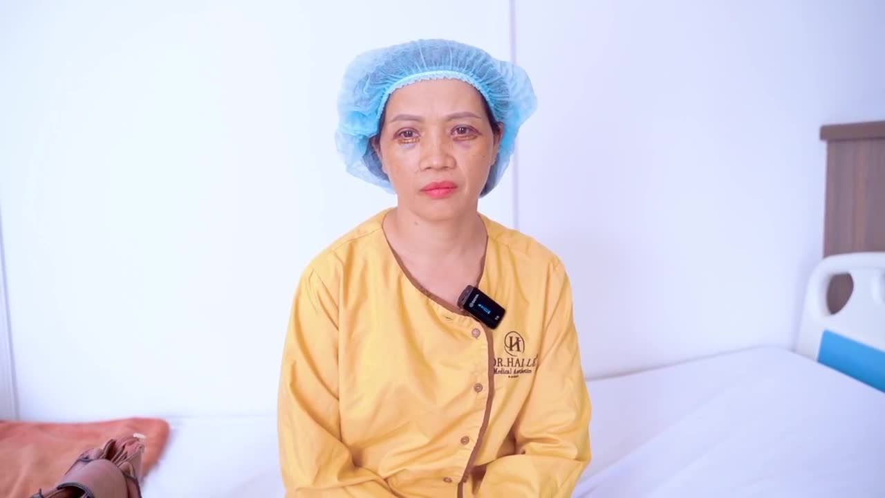 giải cứu ca mí lỗi hỏng trên dưới cho vị khách hàng thành công ngoài sự mong đợi